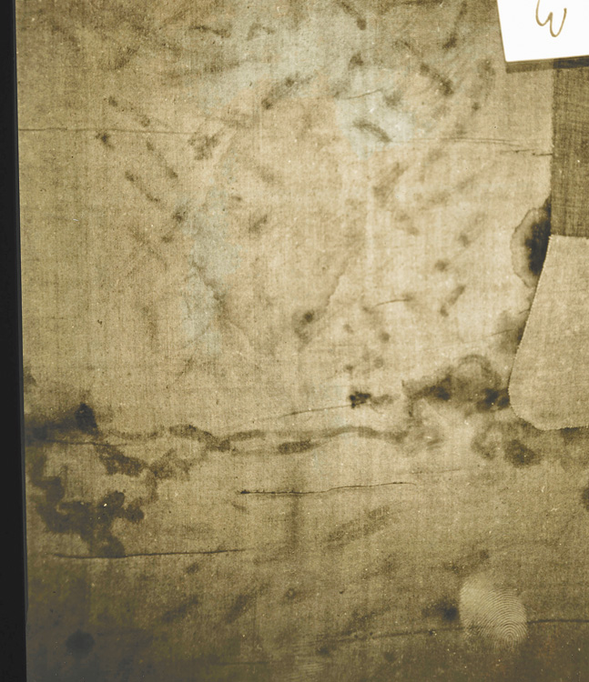1978 年，米勒博士對裹屍布人物背部鞭痕的紫外線攝影。