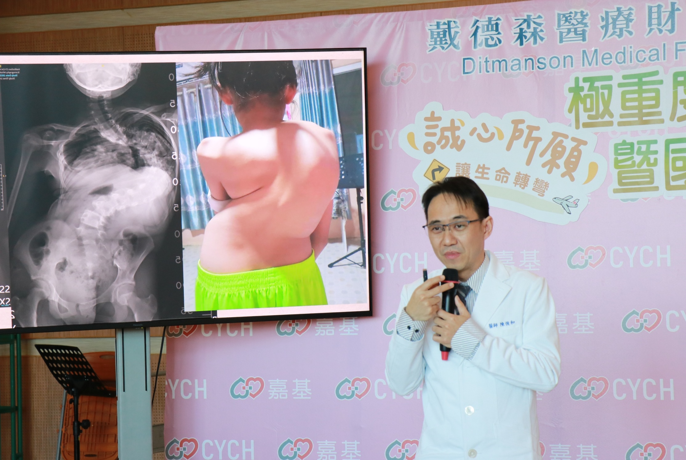 嘉基小兒骨科陳俊和醫師說明誠心脊椎側彎高達極重度的160度。(圖/嘉義基督教醫院提供)
