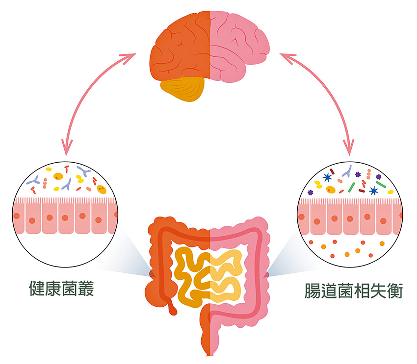 腸道與大腦之間彼此相關。