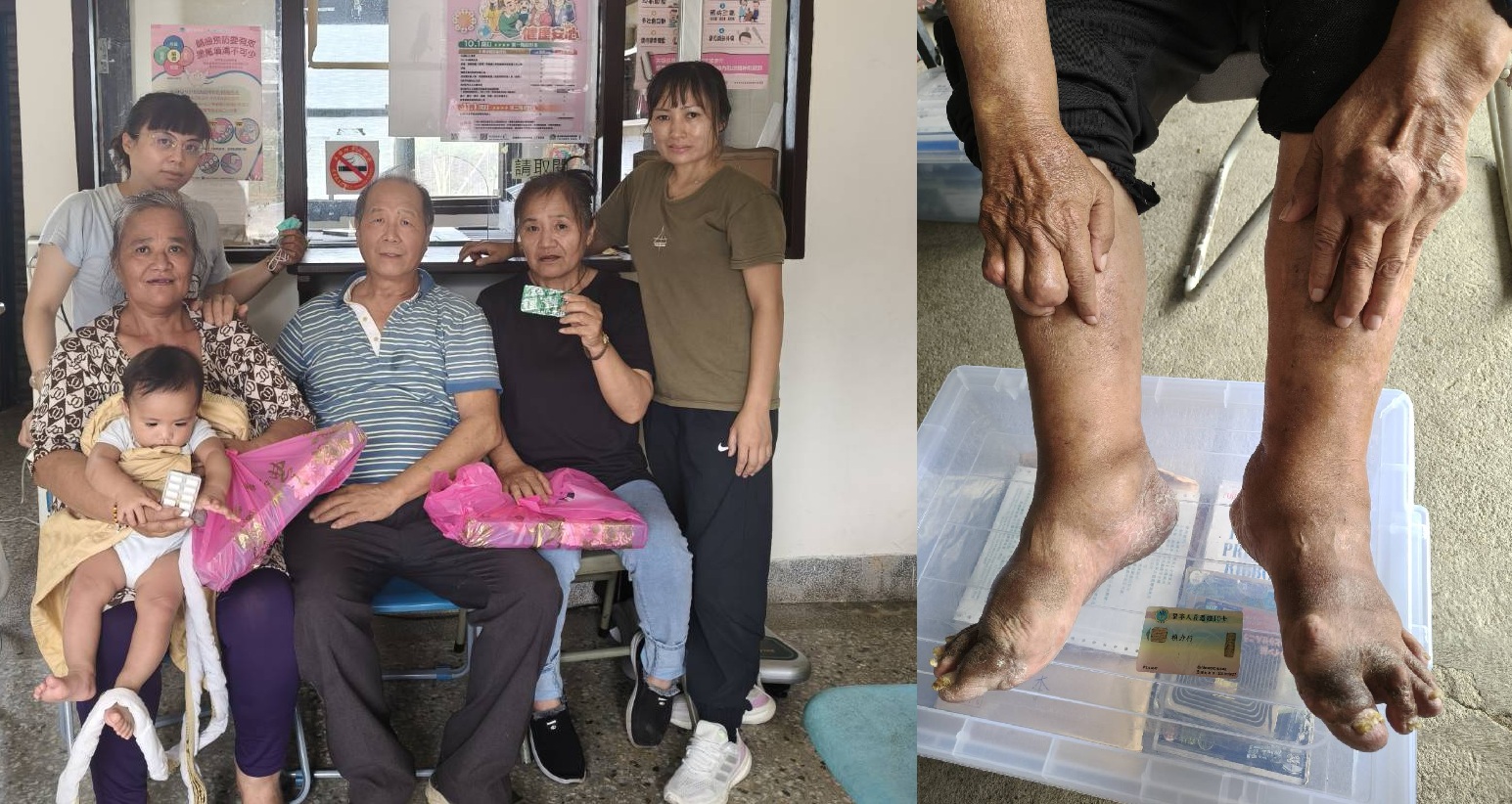 賴醫師協助部落婦女戒菸，自製檸檬汁及月餅相贈以資鼓勵。(右圖)原住民身體最痛的是痛風，賴醫師根據調查研究。(受訪者提通)